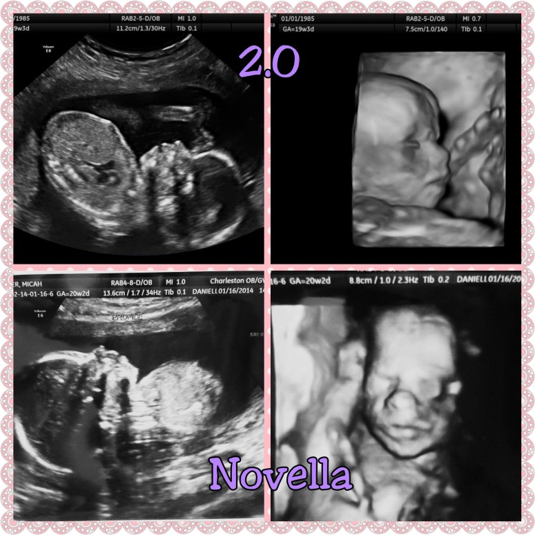 PhotoGrid_1453134297622